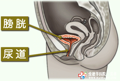 男性长期憋尿会引起膀胱炎吗——九江医大医院