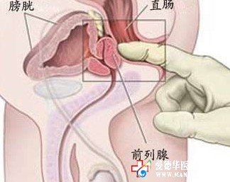 把前列腺炎止于萌芽阶段