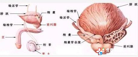 自我如何诊断是否患前列腺炎